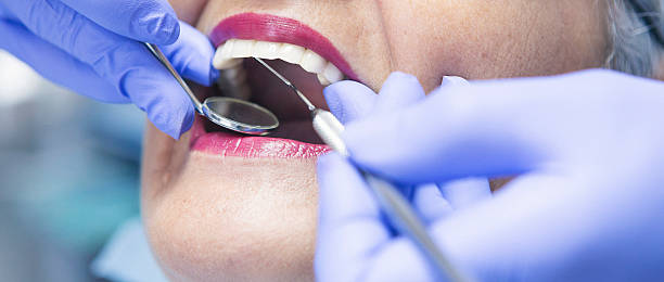 Best Emergency Tooth Extraction in Streetsboro, OH